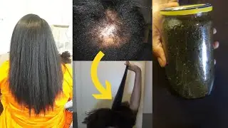 You Won't have excess Breakage nor Shedding again after using this hair Growth treatment Constantly.