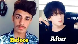 How i Glow up ! Without Any surgery??😲 Part:2