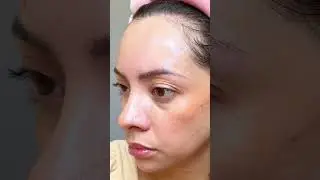 It destroys oil and ensures that your beauty reigns supreme.