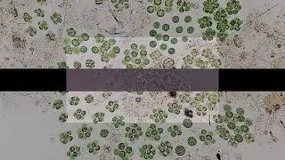 Labcam Microscope/Telescope Adapter For Iphone X