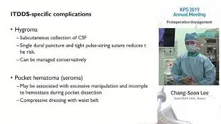 Q&A on the management of intrathecal drug delivery pump implantation.