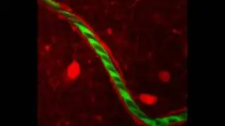 Blood flow in rat brain capillaries: Two-photon microscopy