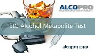 EtG Alcohol Metabolite Test Instructional Video