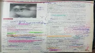 ENT book with added notes and highlighted important points