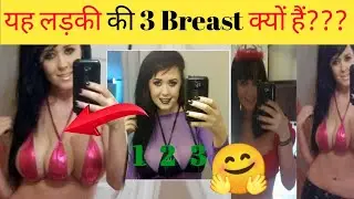 यह लड़की की 3 Breast क्यों हैं? | Girl with three breast|| @FactTechz@MyIndia@Naveendhami7