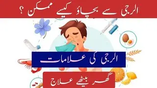 ALLERGY: Causes & Prevention (Simple and Professional) #physiotherapy #allergy #healthtips