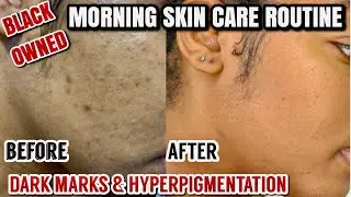 MORNING SKINCARE ROUTINE |CLEARING HYPERPIGMENTATION, DARK MARKS & ACNE |BLACK OWNED |GOLDENCHILDCHI