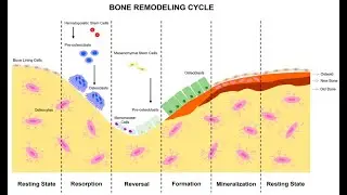 Bone formation rate, Mineralization lag time, Dynamic histomorphometry; study of bone tissue dynamic