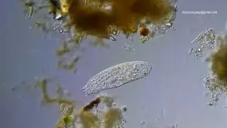 Un ciliado del Orden Hypotrichida - a ciliate of the Hypotrichida Order
