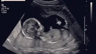 16 week ultrasound baby boy