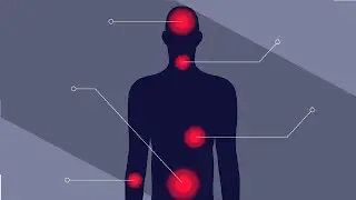 Referred Pain