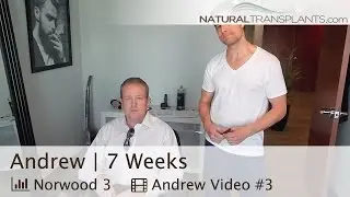 7 Week Hair Loss Surgery Post-Op Check-Up - Natural Hair Transplant - Orlando, Florida (Andrew)