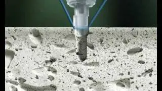 SonicWeld Rx&reg; &ndash; Endobrow fixation