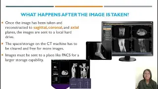 ARRT CT Registry Review: PACS, DICOM, RIS, HIS (CT Physics) | Informatics