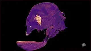 Fly through of an Ant using X-ray Computed Tomography