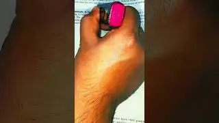 #electric #capacitor #neet2022physics #howtoreadncert#dreamaiims#neet2023 #short #shorts #shortvideo