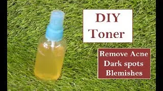 DIY Toner for Acne | Homemade Face Toner for Oily Skin | Remove Pimples, Blemishes, Dark Spots