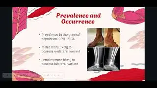 Anatomical Variant Presentation- Accessory Soleus Muscle