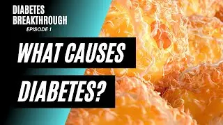The Diabetes Epidemic: Popular Theory on What Causes Diabetes [Diabetes Breakthrough Episode 1]