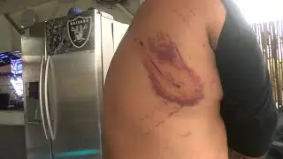 Ewa Beach man &lsquo;grateful to be alive&rsquo; after dog attack