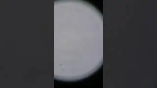 Focusing the Microscope Using the Oil Immersion Lens (1000X Objective)