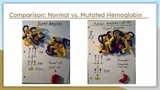 The Hemoglobin Beta (E6V) Mutation by Marcus Walton
