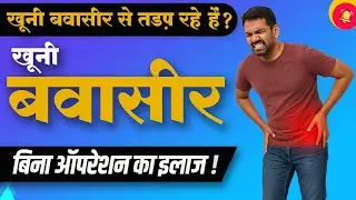 Pilesure Capsule Review | Bleeding Piles Cure | Dr. Mayur Sankhe