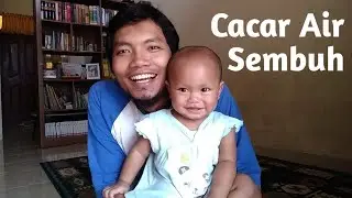 Mengobati dan Merawat Cacar Air pada Anak