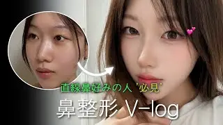 [整形密着Vlog]存在感のある直線ラインの鼻（直線鼻）｜リアルな経過と変化（直線鼻Vlog）🥰