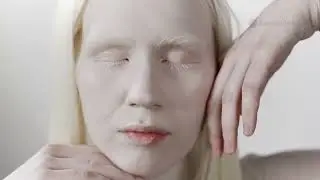 Is It Stress, Sleep, or Something Else Eye Twitching Demystified!
