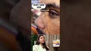 Sanfe Kesar Exfoliating Gel