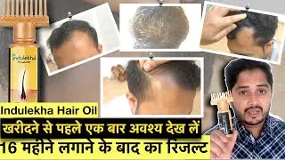 16 महीने Indulekha Hair Oil use करने के बाद का Result । Indulekha hair Oil Review.
