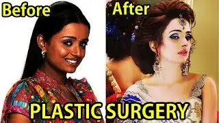 Plastic Surgery Of Popular TV Actress  - BEFORE & AFTER