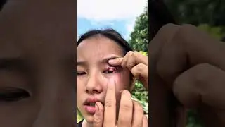 How to Get Dust Out of Your Eye Safely (Without Rubbing Your Eyes!)#camping #survival #lifehacks