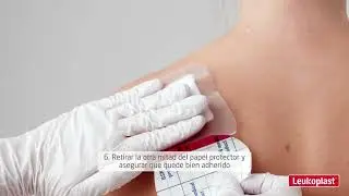 Fijación de apósitos por lesiones en la piel con Hypafix® Transparente