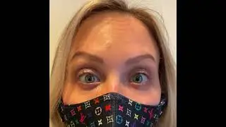 The Botox Timeline!