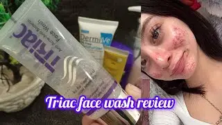 Triac anti acne face wash review||treatment for acne prone skin || best face wash for acne||