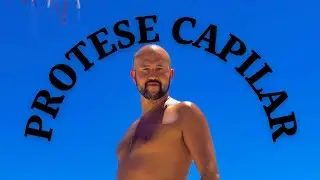 Dicas Necessárias completa para Prótese Capilar | @Jadson.andresen