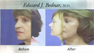 Bednar Cosmetic Surgery - Facial Rejuvenation Approaches