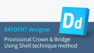 RAYDENT designer workflow - Provisional Crown & Bridge Using Shell technique method