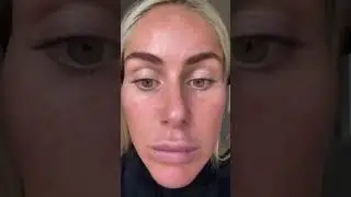 Result ZENA Peeling Algae  - Step by Step#zenabeauty #zenacosmetics #zenaalgaepeeling #zenapeeling