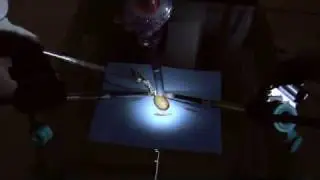 Precision of Robotic Surgery  Peeling a Grape