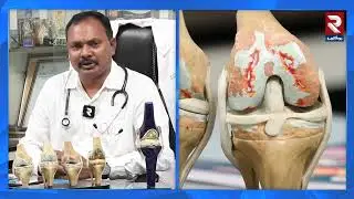 ఎముకల బలహీనత పై చాపల వంశీకృష్ణ సూచనలు   Dr Vamsi Krishna About Bone Weakness   RTV Ongole