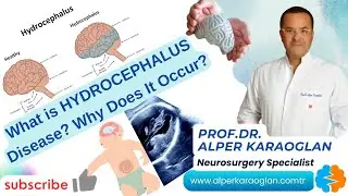 What is HYDROCEPHALUS Disease? Why Does It Occur? | Prof Dr Alper KARAOGLAN