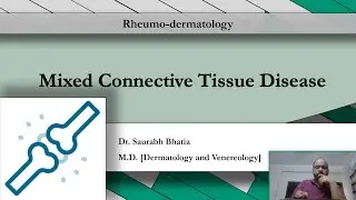 Mixed Connective Tissue Disease: Epidemiology, Pathology, Features, and Management