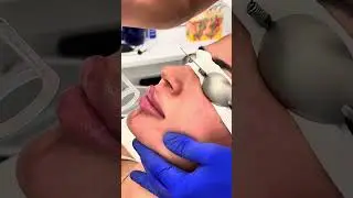 Did we get you? For a second? 🤣 #viral #skintreatment #laser #skincare #lasertreatment #torontospa