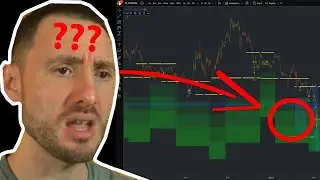 This one indicator will enhance your QFL trades | Biggest Mistakes When Trading QFL