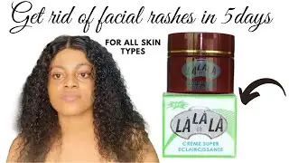 Honest review on lalala face cream | for all skin types| lalala review, best face cream