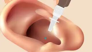 วิธีการใช้ยาหยอดหู (Ear drops) - กองเภสัชกรรม สำนักอนามัย กรุงเทพมหานคร