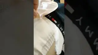 операция